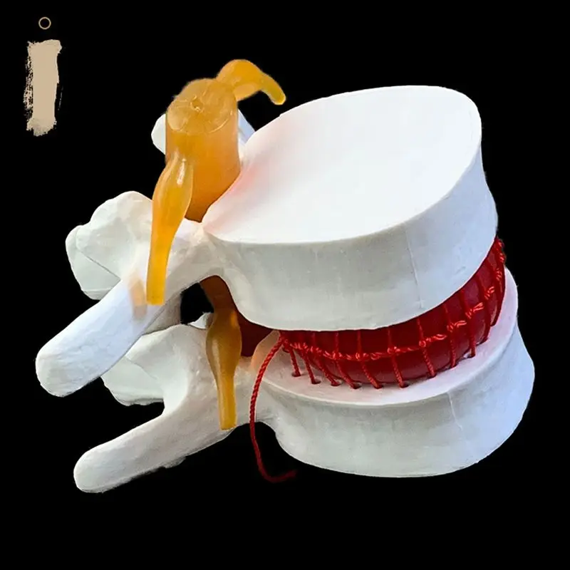 Anatomik İnsan Lomber Vertebra - Examination Bed Medical incelemesi ve fiyatı