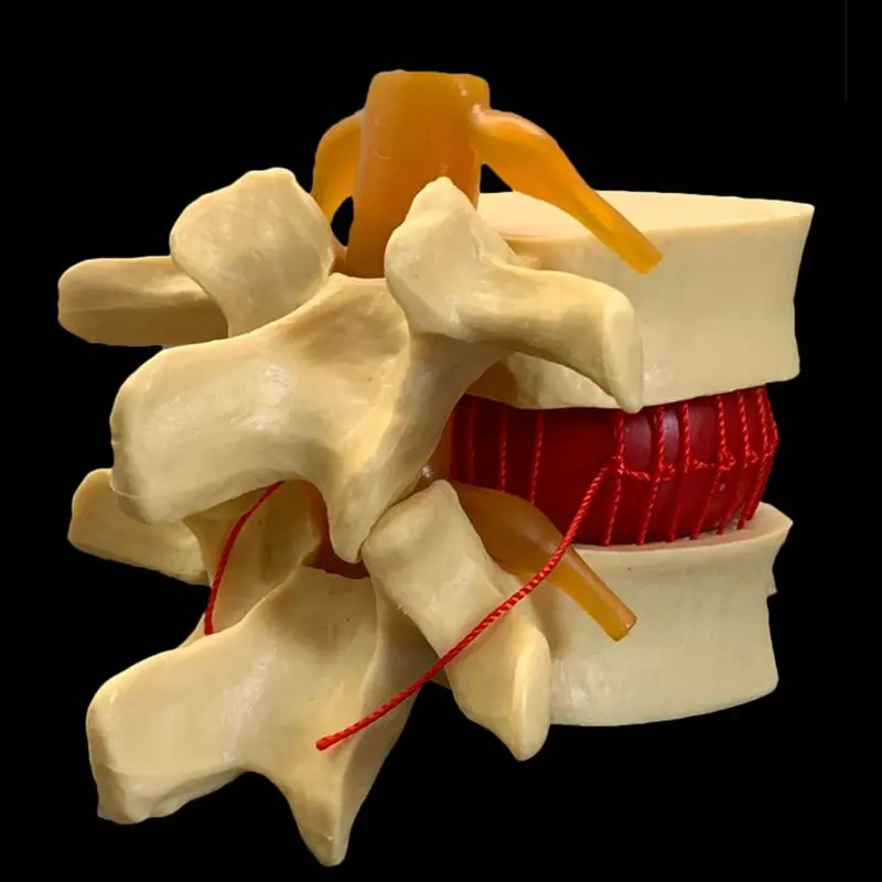 Anatomik İnsan Lomber Vertebra - Examination Bed Medical incelemesi ve fiyatı